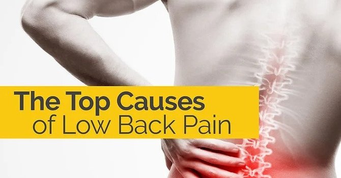 The Top Causes of Low Back Pain image